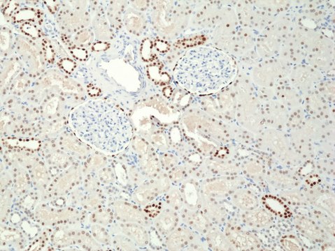 Anti-PAX8 Rabbit Monoclonal Antibody