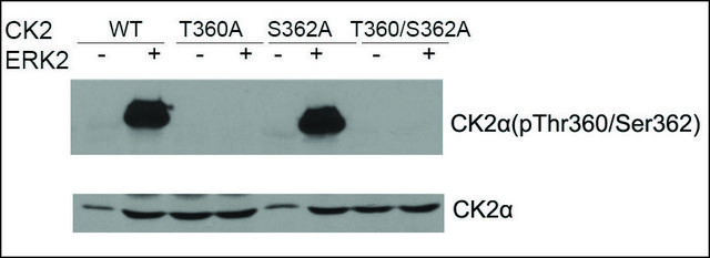 Anti-CK2? antibody produced in rabbit