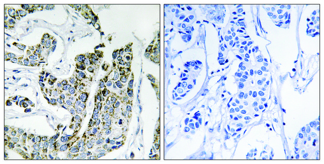 Anti-phospho-BLK (pTyr??¹) antibody produced in