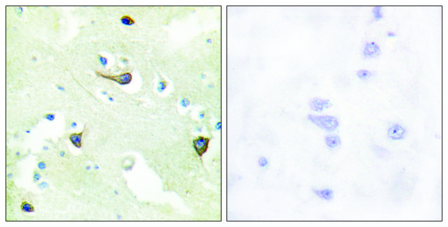Anti-EPHB1 antibody produced in rabbit