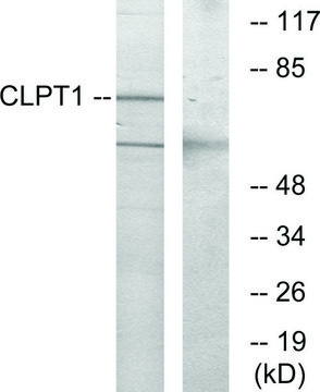 Anti-CLPT1 antibody produced in rabbit