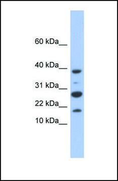 Anti-NDUFC1 antibody produced in rabbit