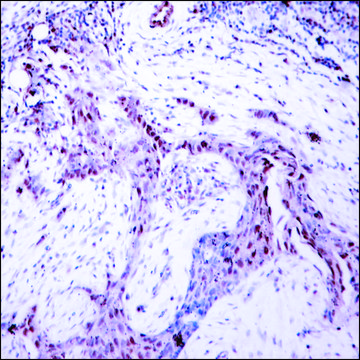 Anti-phospho-PGR (pSer¹??) antibody produced in