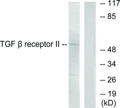 Anti-TGF ? Receptor II antibody