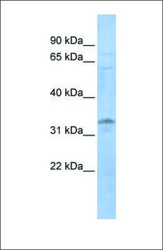 Anti-LYL1 antibody produced in rabbit