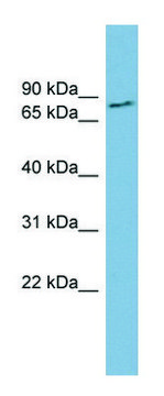 Anti-FURIN (N-terminal) antibody produced in