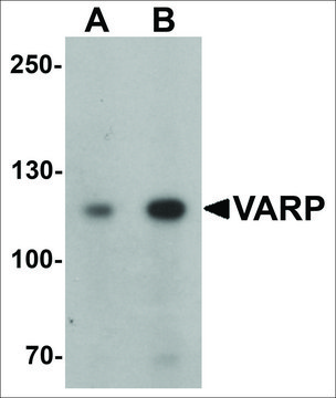 Anti-ANKRD27 antibody produced in rabbit