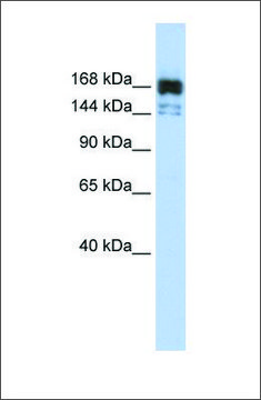 Anti-XRN1 antibody produced in rabbit