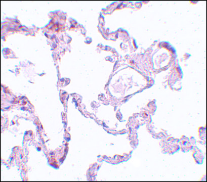 Anti-PLEKHM1 antibody produced in rabbit