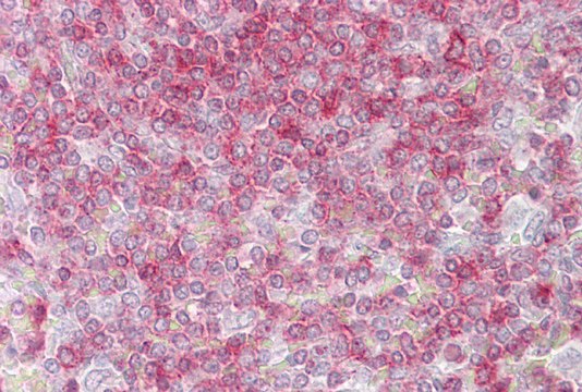 Anti-RIPK3 antibody produced in rabbit