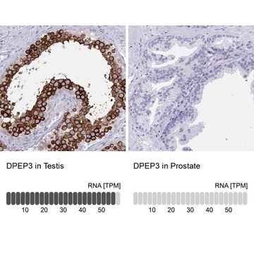Anti-DPEP3 antibody produced in rabbit