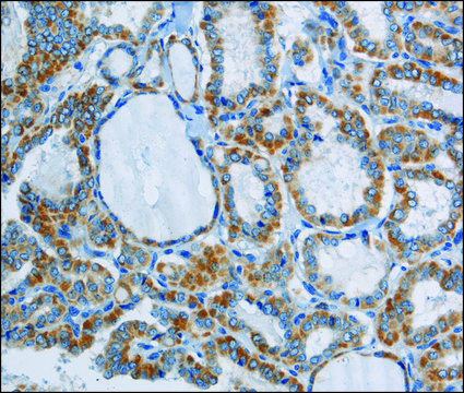 Anti-PPARGC1B antibody produced in rabbit
