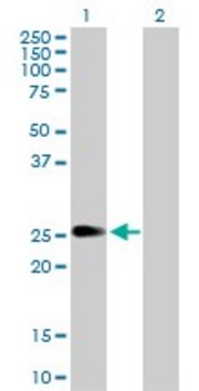 Anti-PIP5K1C antibody produced in rabbit