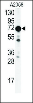 Anti-BPIL2 (N-term) antibody produced in