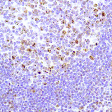 Anti-Nucleophosmin antibody, Rabbit monoclonal