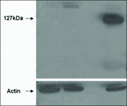Anti-TNKS2 antibody produced in goat