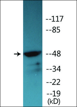 Anti-phospho-Vitamin D Receptor (pSer²??) antibody