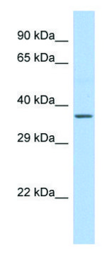 Anti-CYTB (C-terminal) antibody produced in