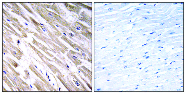 Anti-FGF18 antibody produced in rabbit