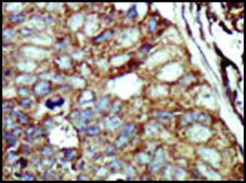 Anti-DGKQ (C-term) antibody produced in