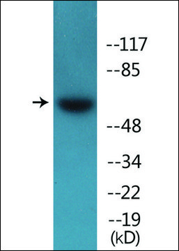 Anti-phospho-Src (pTyr?¹?) antibody produced in