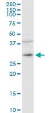 Anti-CER1 antibody produced in rabbit