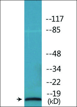 Anti-phospho-STMN1 (pSer?²) antibody produced in