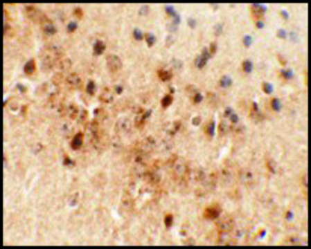 Anti-C1orf187 antibody produced in rabbit