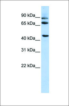 Anti-DPP10 antibody produced in rabbit