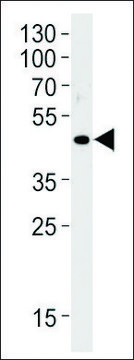 ANTI-OR51E1(C-TERMINAL) antibody produced in rabbit