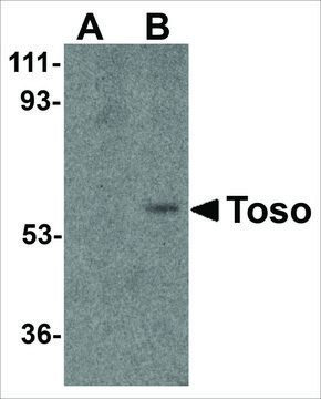 Anti-Toso antibody produced in rabbit