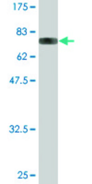 Monoclonal Anti-YARS antibody produced in