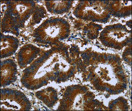 Anti-CERS5 antibody produced in rabbit