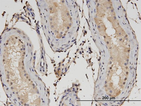 Monoclonal Anti-C1orf89 antibody produced in
