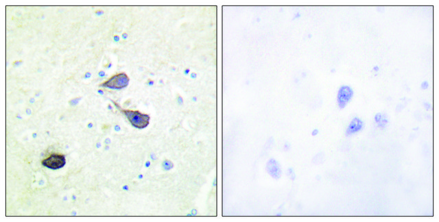 Anti-KOR-1 antibody produced in rabbit
