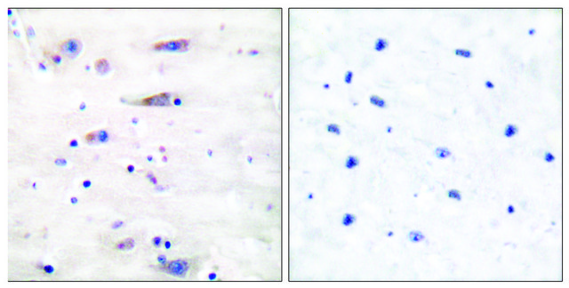 Anti-NMDAR1 antibody produced in rabbit