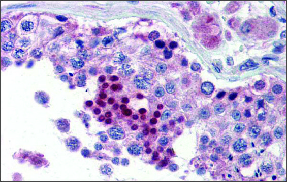 Anti-NR0B1 antibody produced in rabbit
