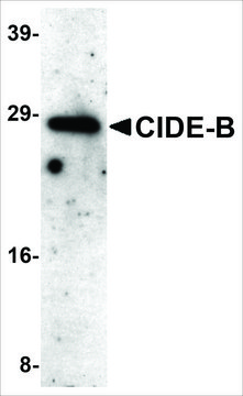 Anti-CIDE-B (ab3) antibody produced in