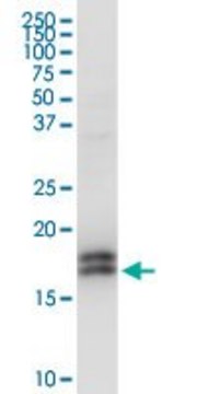 Anti-NPC2 antibody produced in rabbit