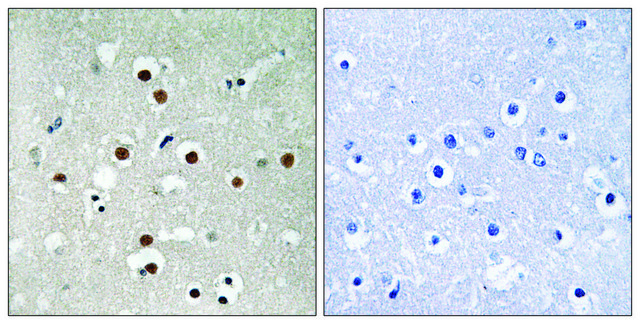 Anti-phospho-MEF2C (pSer³??) antibody produced in