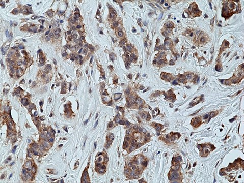 Anti-p70S6K Rabbit Monoclonal Antibody