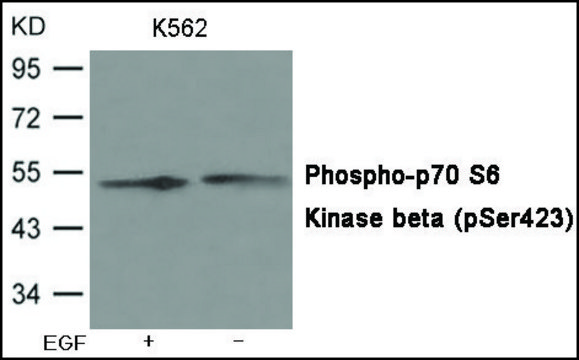Anti-phospho-p70 S6 Kinase ? (pSer?²³)