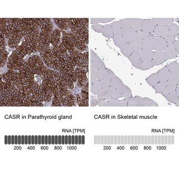 Anti-CASR antibody produced in rabbit