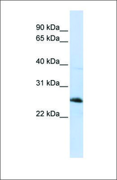 Anti-RTN1 (ab1) antibody produced in