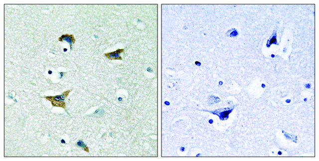 Anti-FAK antibody produced in rabbit