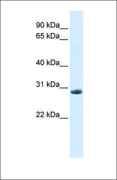 Anti-YIPF6 antibody produced in rabbit