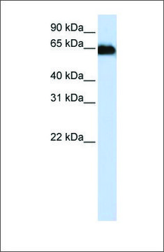 Anti-ADAM12 antibody produced in rabbit