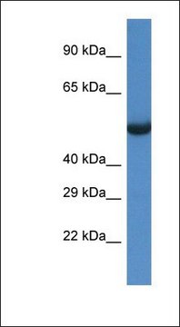 Anti-SESN1 antibody produced in rabbit