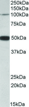 Anti-PTCHD1 antibody produced in goat