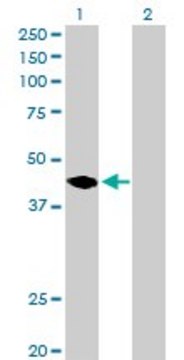 Anti-MAGEA11 antibody produced in rabbit